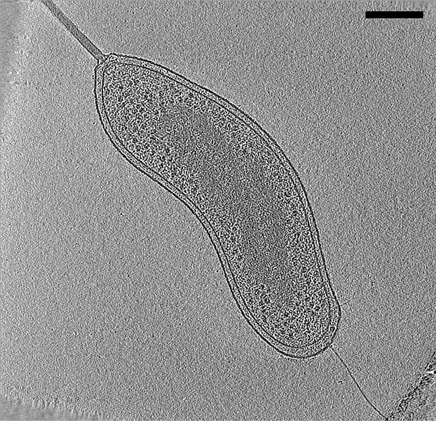 Bdellovibrio bacteriovorus