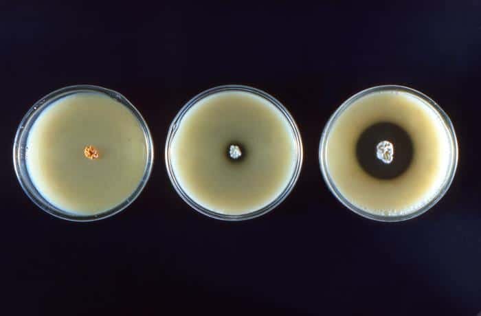 Placa de Petri con Nocardia y Streptomyces