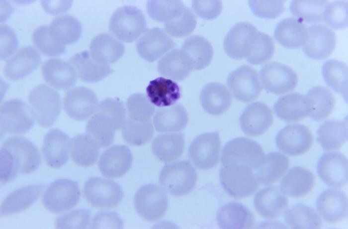 Plasmodium malariae - TinciÃ³n de Giemsa