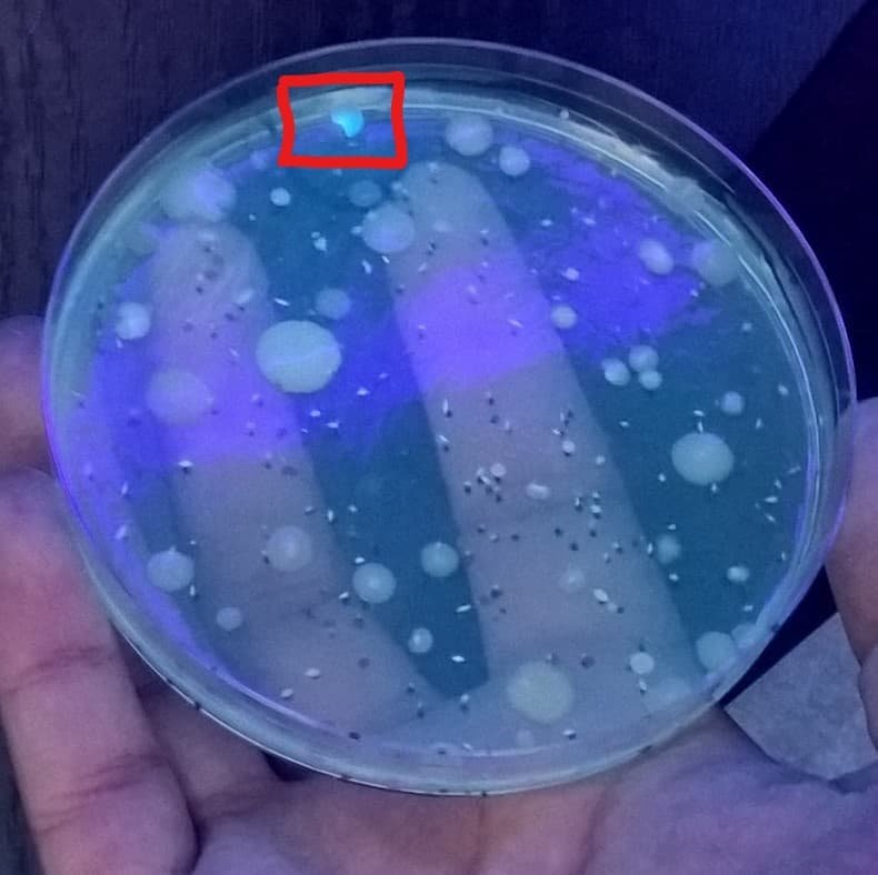 Pseudomonas fluorescente en muestra de agua