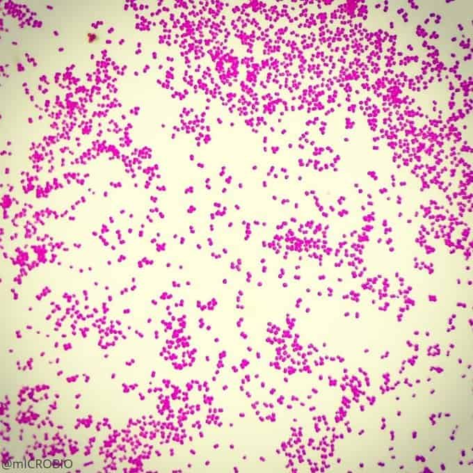 Acinetobacter baumannii - Tinción de Gram