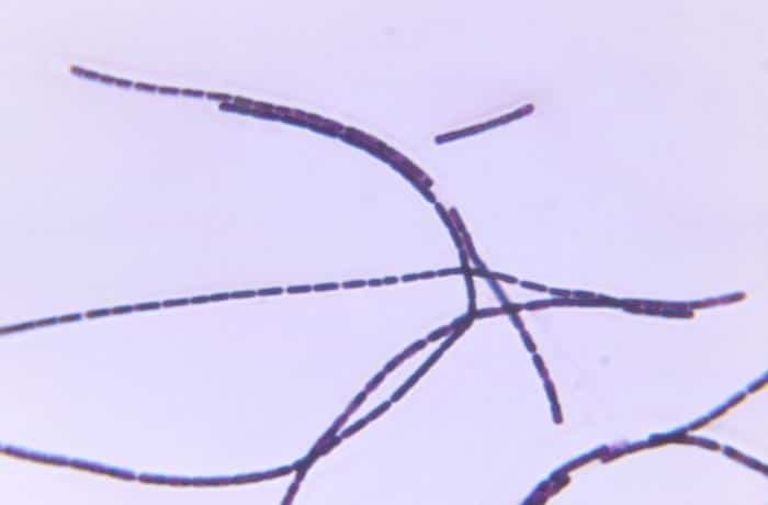Bacillus anthracis - Tinción de Gram