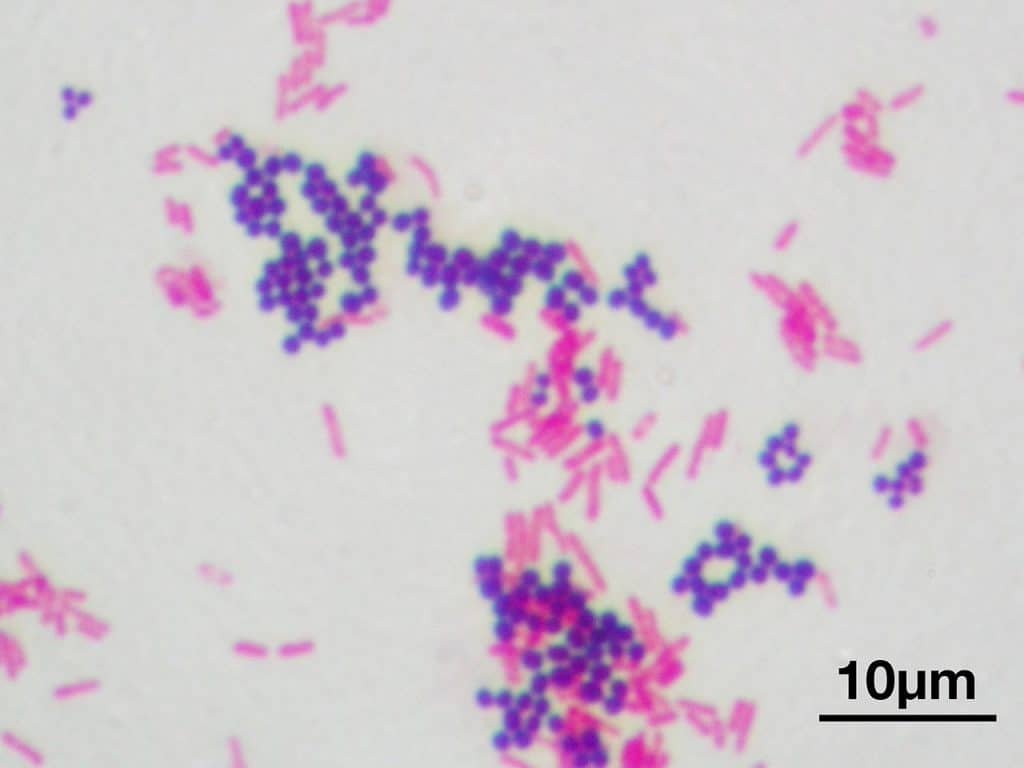 Escherichia coli - Tinción de Gram