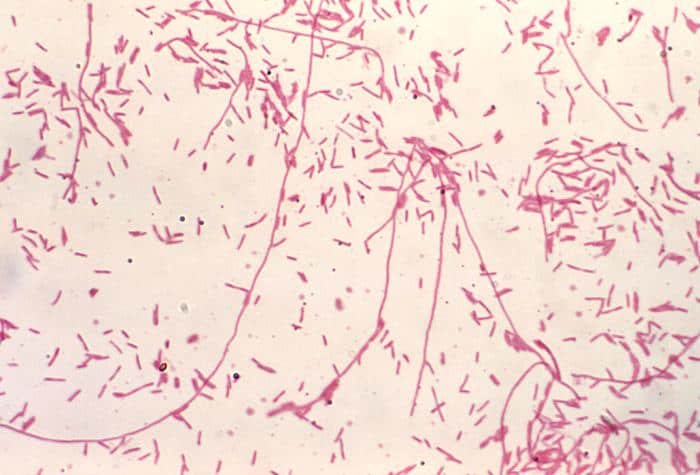 Legionella pneumophila - Tinción de Gram