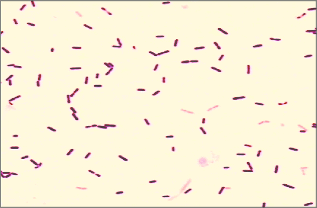 Listeria monocytogenes - Tinción de Gram