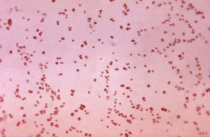 Neisseria gonorrhoeae - Tinción de Gram