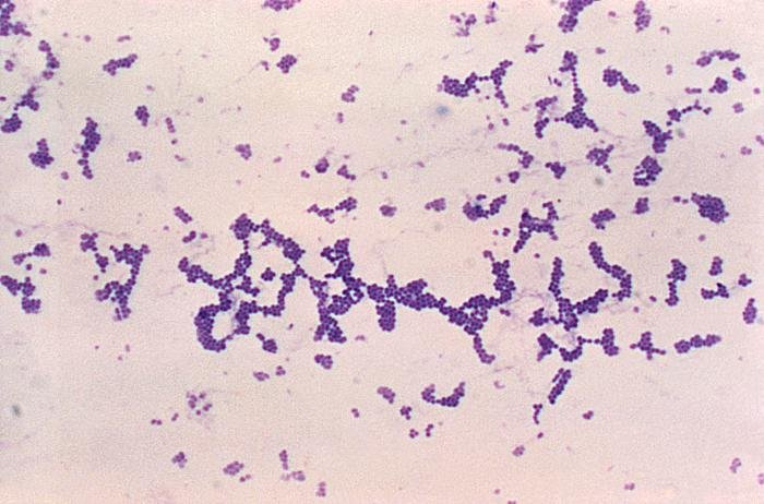 Staphylococus aureus - Tinción de Gram