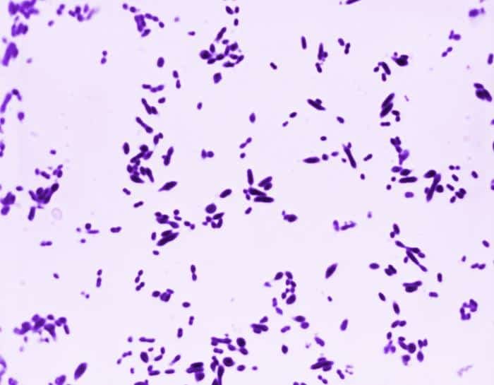 Streptococcus pneumoniae - Tincion de Gram
