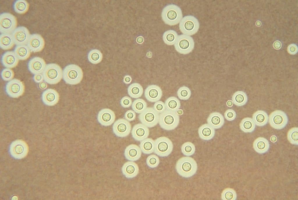 Cryptococcus neoformans - tinción negativa con tinta china.