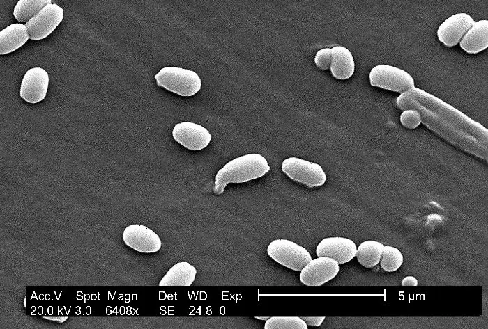 Visión de Bacillus anthracis en el microscopio electrónico de barrido